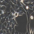 人未分化胃癌细胞_HGC-27