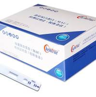 尿微量白蛋白定量检测试剂盒