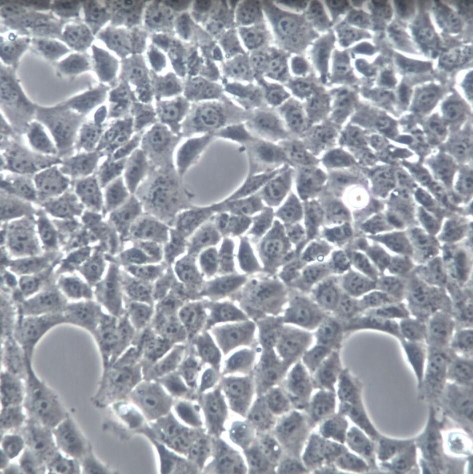 TM3、TM3细胞系、TM3细胞株、TM3小鼠睾丸间质细胞