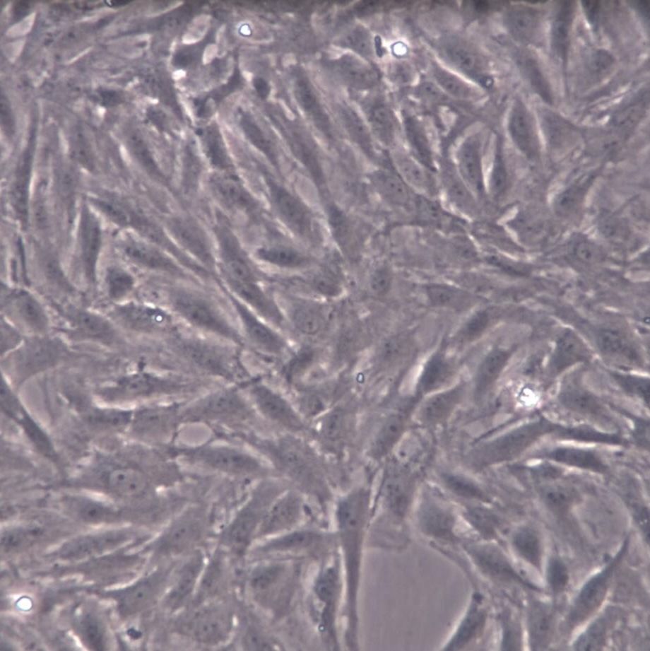 RBMVEC、RBMVEC细胞系、RBMVEC细胞株、RBMVEC大鼠脑微血管内皮细胞永生化