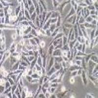 SW480人结肠腺癌细胞