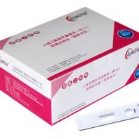 人绒毛膜促性腺激素（HCG）定量检测试剂盒