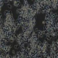 LS 174T人结肠腺癌细胞