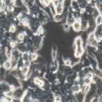 LoVo结肠癌细胞培养说明书