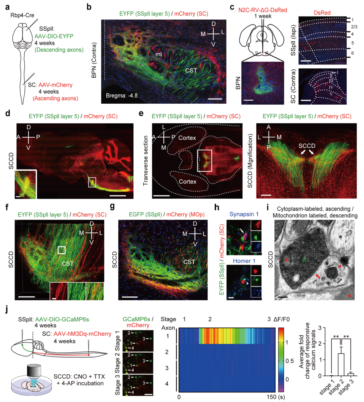科技前沿 | 广东省智能院张旭院士研究团队发现一条传导痛觉的脊髓-皮层直接通路