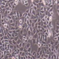 HCCLM3 人高转移肝癌细胞