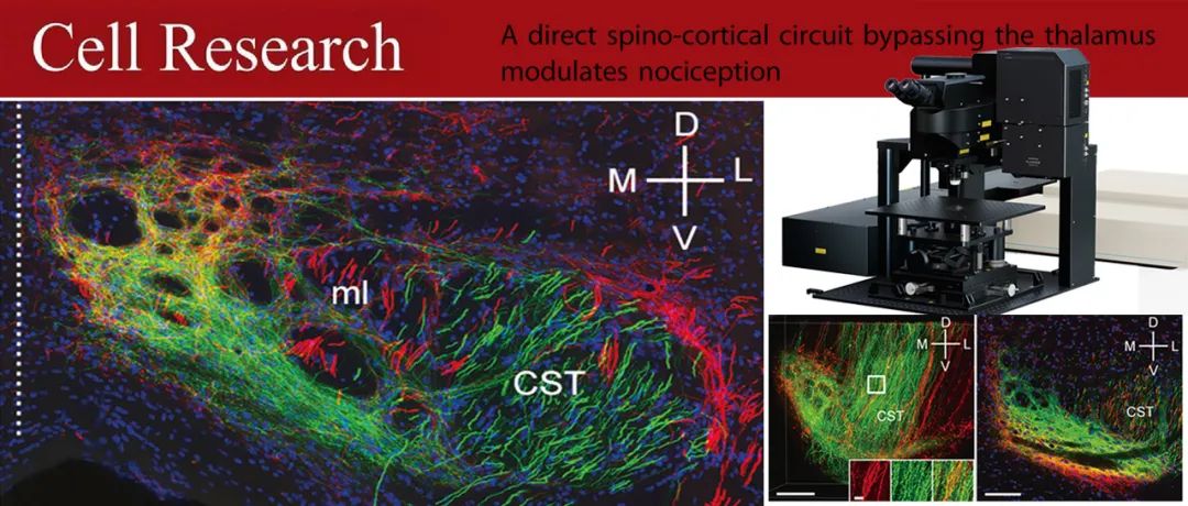 科技前沿 | 广东省智能院张旭院士研究团队发现一条传导痛觉的脊髓-皮层直接通路