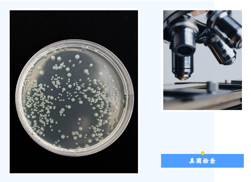 当皮肤遇上真菌感染，怎么检查？