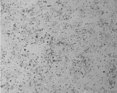 细胞攻略 | SK-BR-3(人乳腺腺癌细胞)培养教程