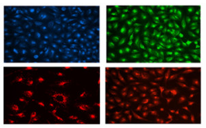 溶酶体免疫荧光法