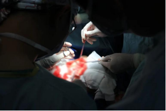 7 个小时，深圳市龙岗区人民医院这个医生团队将口水引到眼睛