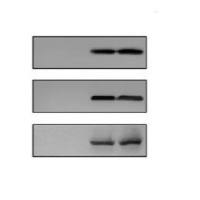 外泌体WB鉴定实验服务