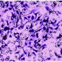 Transwell细胞迁移实验