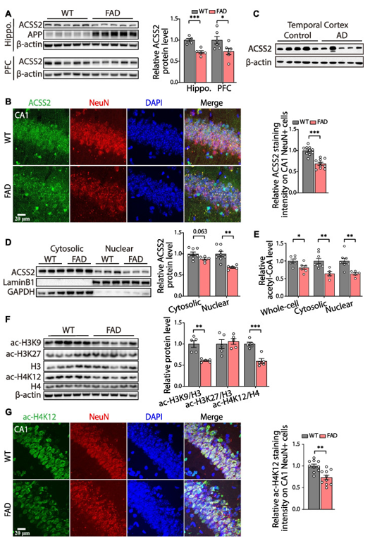 IF＞15 | 揭示ACSS2在阿尔茨海默病（AD）中调控的新机制