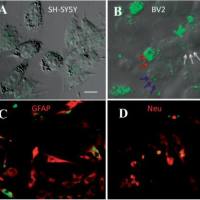 外泌体标记慢病毒包装