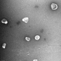 外泌体电镜检测