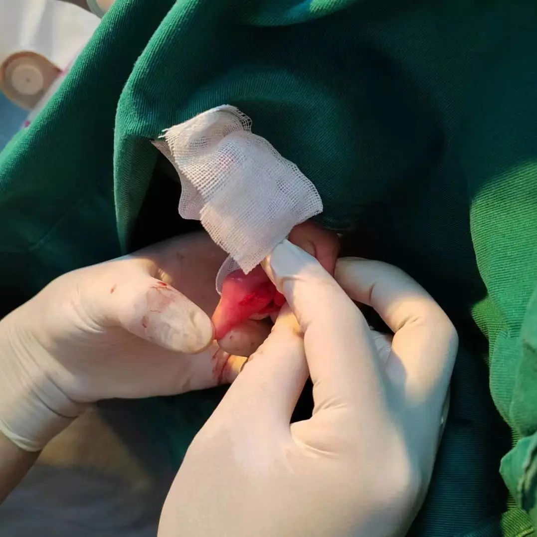 家长必看！宝宝手指红肿，元凶竟是它！