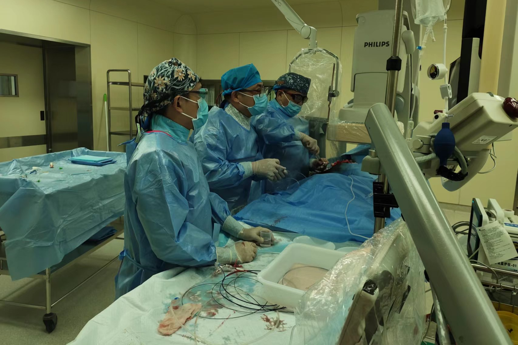 西安交大一附院东院区：成功为 92 岁高龄患者实施机械血栓抽吸术