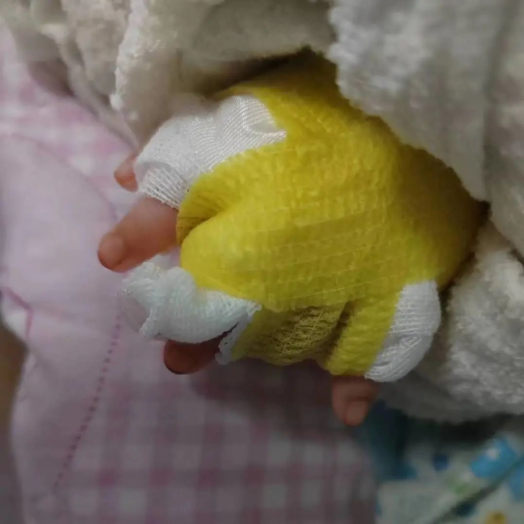 家长必看！宝宝手指红肿，元凶竟是它！