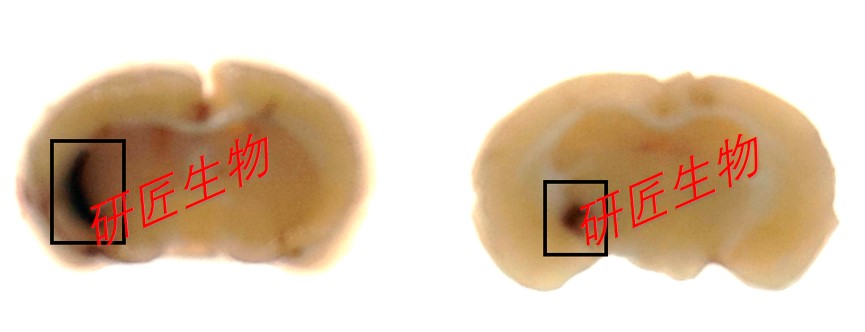 脑出血—胶原酶造模