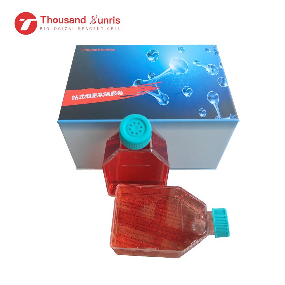 TU212 人喉癌细胞(STR鉴定）