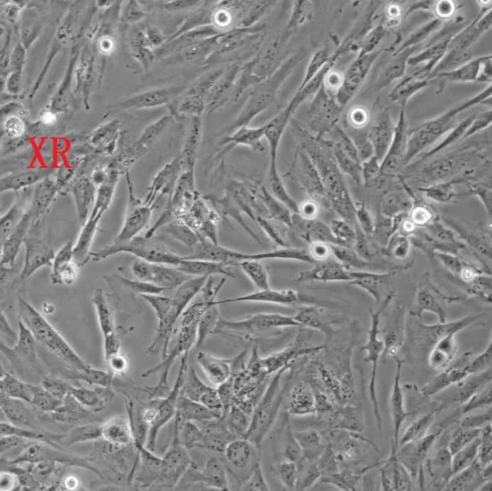 Patu8988S人胰腺癌细胞、Patu8988S细胞（附STR鉴定报告）