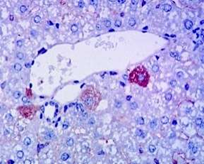 IPHASE组织交叉反应（TCR）产品整体解决方案