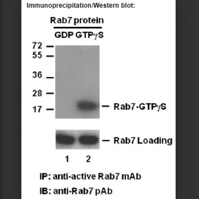 Rab7-GTP 