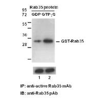Rab35-GTP 小鼠单抗
