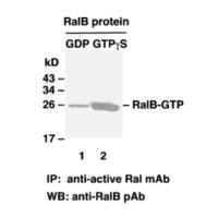 RalB Pull-Down Activation Assay Kit