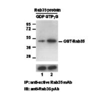 Rab35 Pull-Down Activation Assay Kit