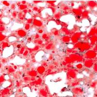油红O染色