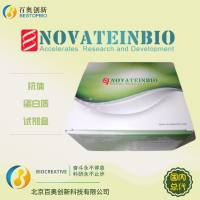 Rat Anti-Thyroid Microsome Antibody ATMA ELISA Kit