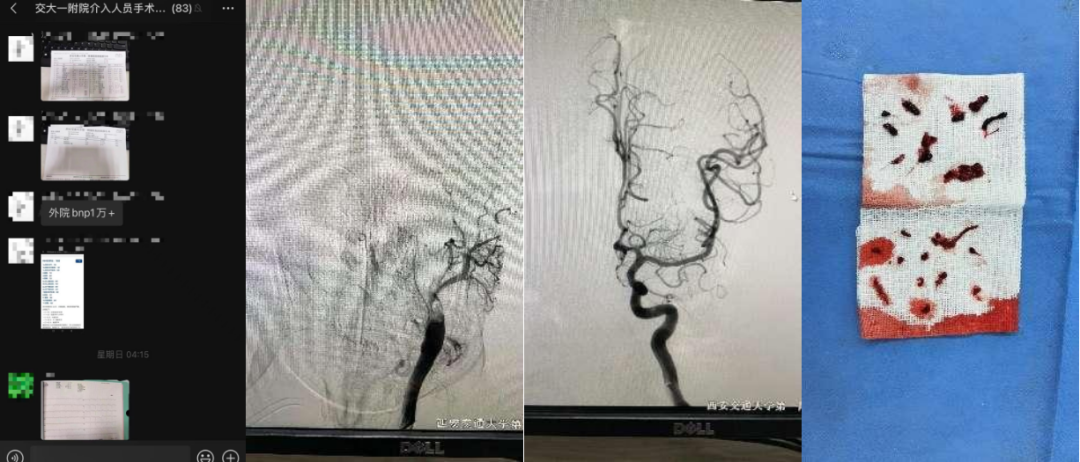 西安交大一附院假期成功救治多名急危重症患者