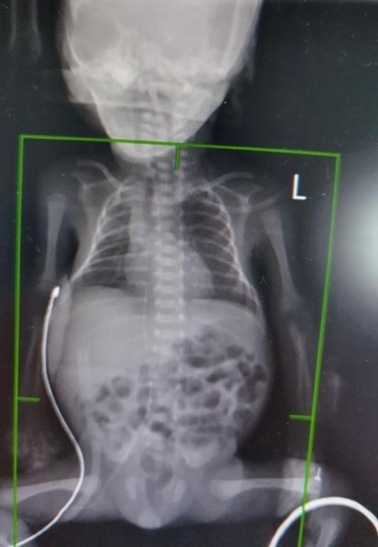 西安交大一附院假期成功救治多名急危重症患者