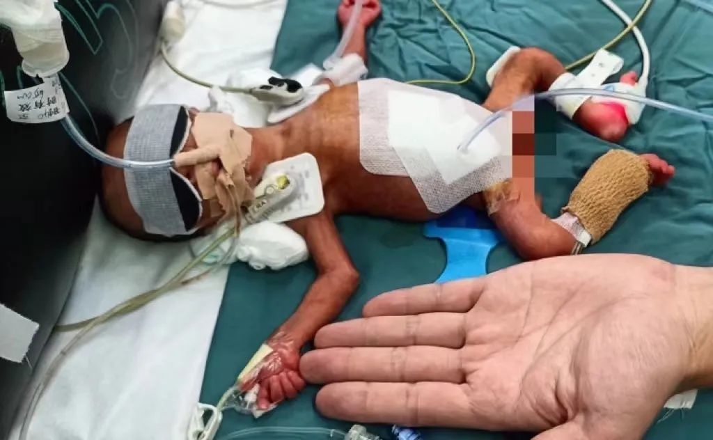 西安交大一附院假期成功救治多名急危重症患者