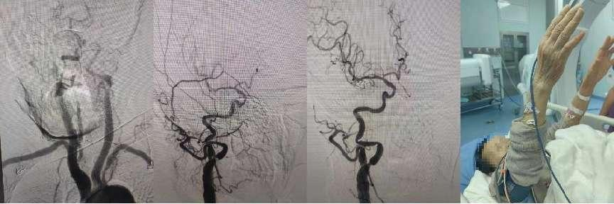 西安交大一附院假期成功救治多名急危重症患者