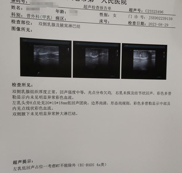 全景医学乳腺磁共振动态增强检查助力早期乳腺癌筛查诊断