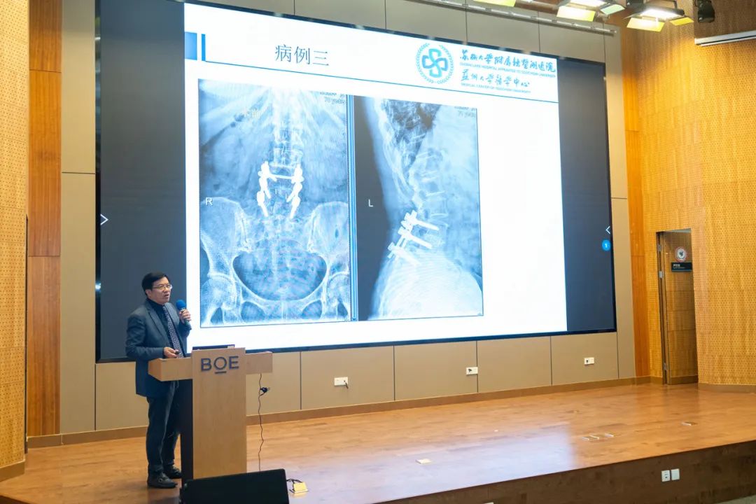 【学术交流】沪苏皖专家共议脊柱微创新技术