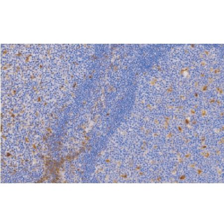兔抗人α-1-抗胰糜蛋白酶多克隆抗体