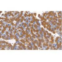 兔抗人甲胎蛋白单克隆抗体