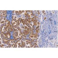 鼠抗人间变性淋巴瘤激酶单克隆抗体