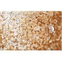 兔抗人α-1-抗胰蛋白酶多克隆抗体