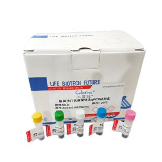 小鼠肝炎病毒染料法荧光定量RT-PCR试剂盒