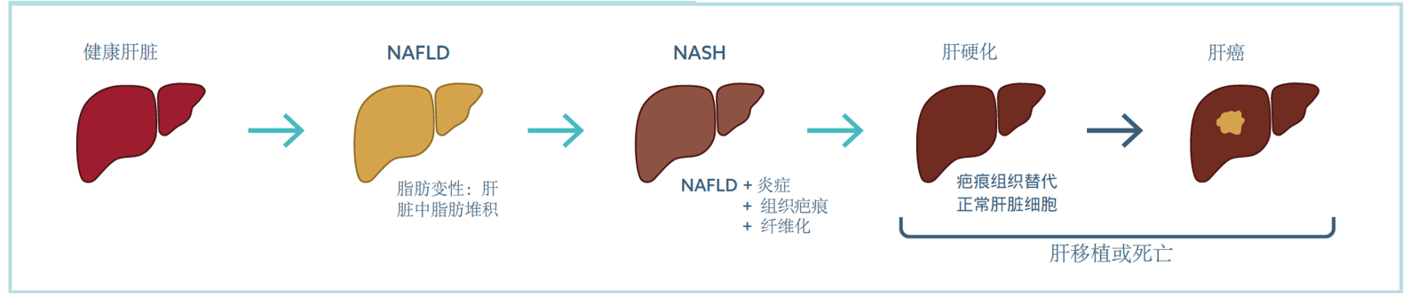 CN-Bio器官芯片应用 ——非酒精性脂肪肝炎（NASH）_上海曼博生物