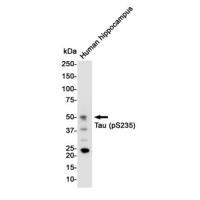 Anti-Tau (phospho S235)