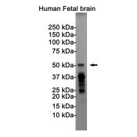 Anti-Tau (phospho T205)