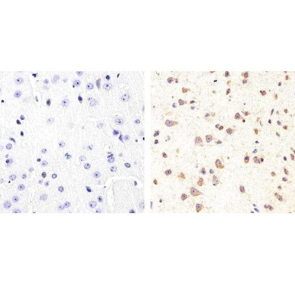 Anti-Tau (phospho S409)