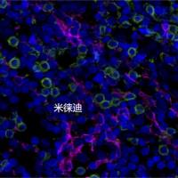 多色荧光免疫组化全流程服务--2标3色