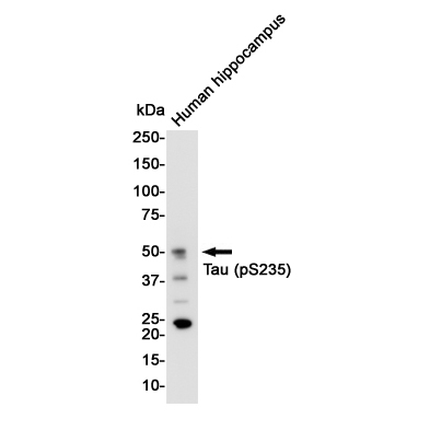 Anti-Tau (phospho S235)